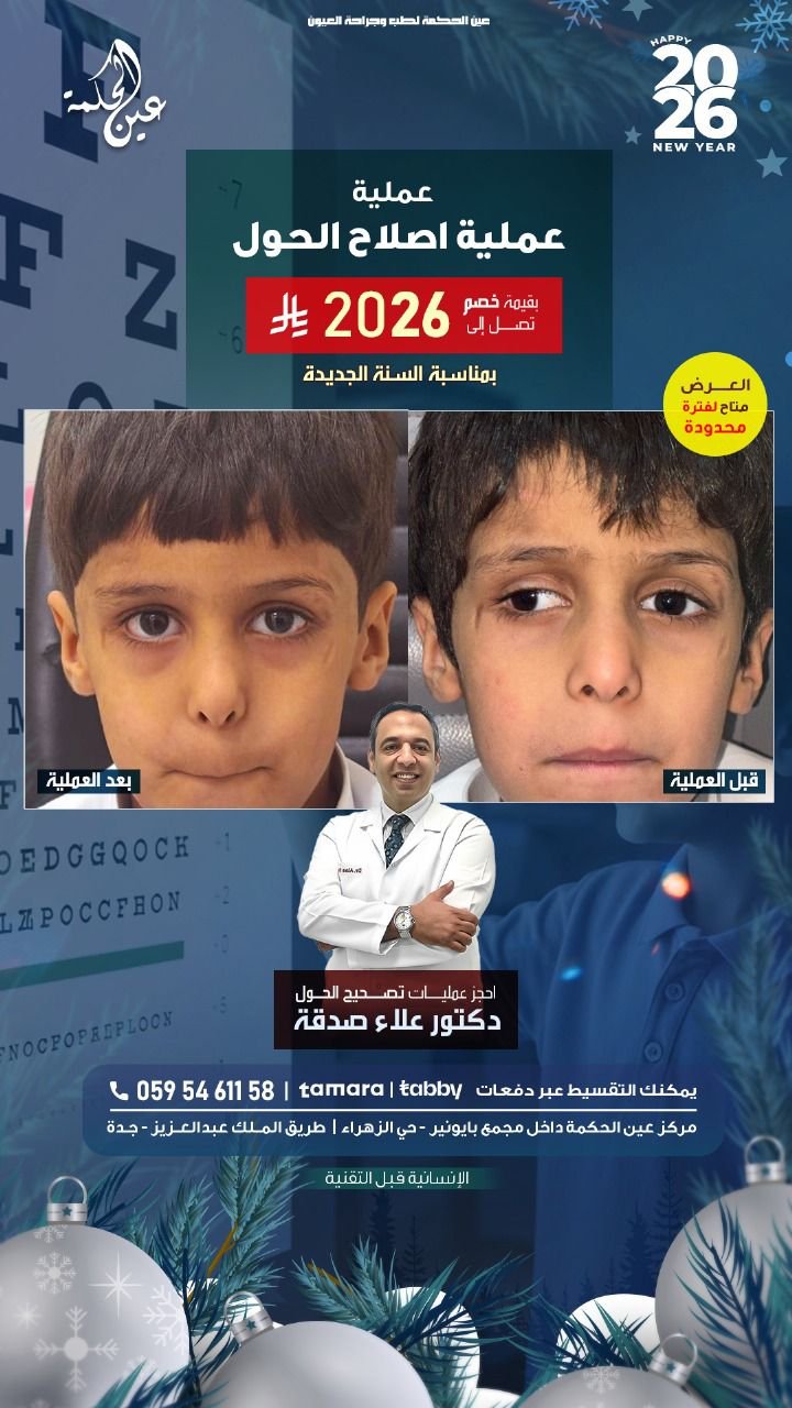 عملية إصلاح الحول - دكتور علاء صدقة