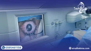 الفرق بين تقنيات الليزك والفيمتو سمايل 2 الفرق بين تقنيات الليزك والفيمتو سمايل