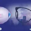 لماذا تفشل النظارات الطبية في علاج القرنية المخروطية