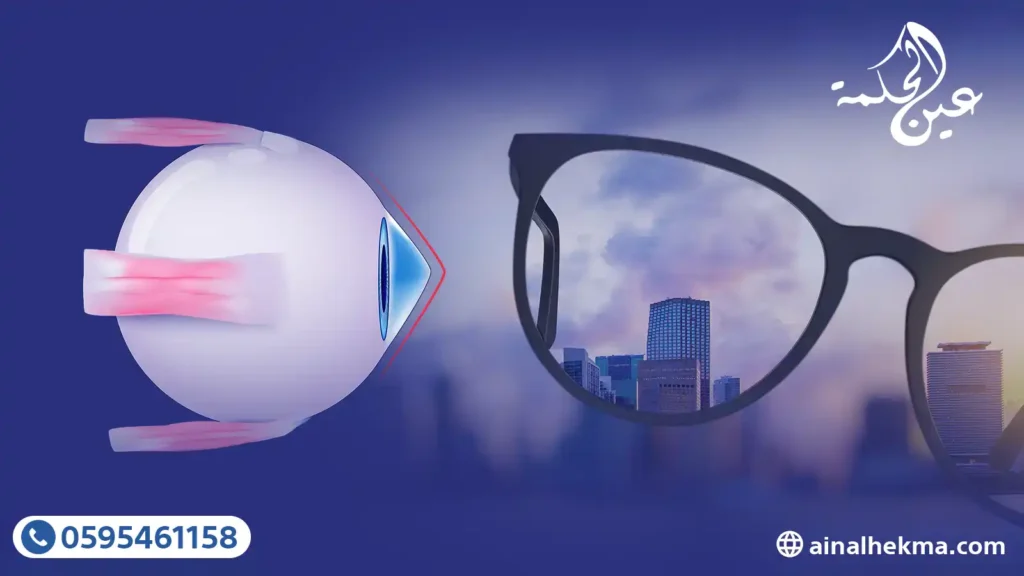 لماذا تفشل النظارات الطبية في علاج القرنية المخروطية 4 لماذا تفشل النظارات الطبية في علاج القرنية المخروطية