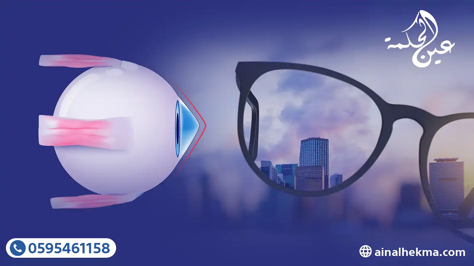 لماذا تفشل النظارات الطبية في علاج القرنية المخروطية 1 لماذا تفشل النظارات الطبية في علاج القرنية المخروطية